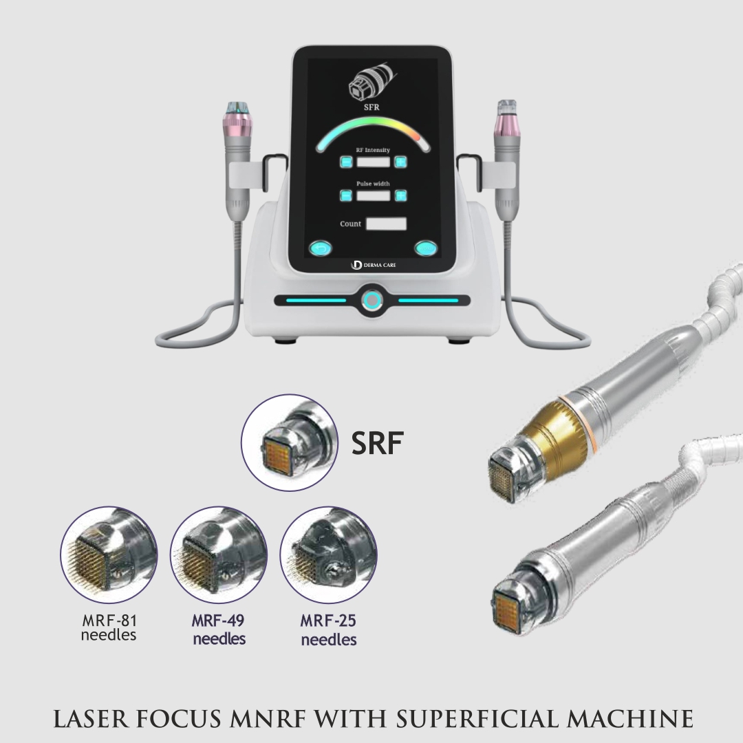 LASER FOCUS MNRF WITH SUPERFICIAL MACHINE